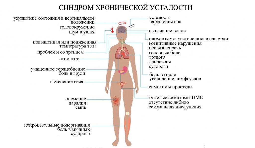 Симптомы хронической усталости Симптомы хронической усталости