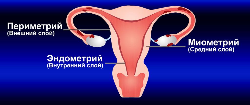 Стенка матки состоит из эндометрия, миометрия и периметрия Стенка матки состоит из эндометрия, миометрия и периметрия