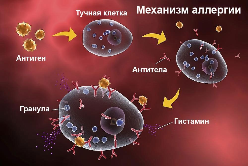 Механизм аллергии
