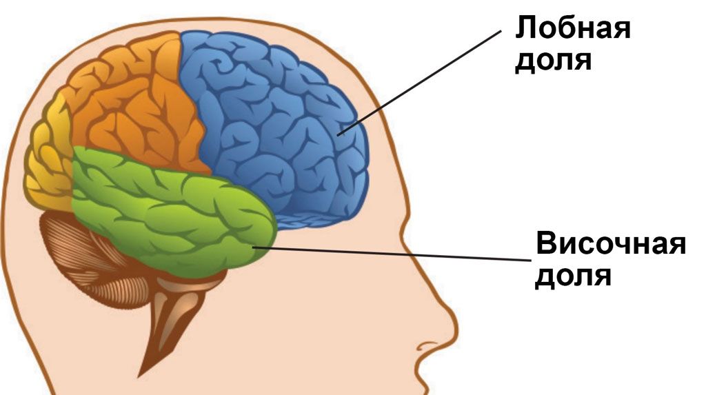 Лобно-височная деменция