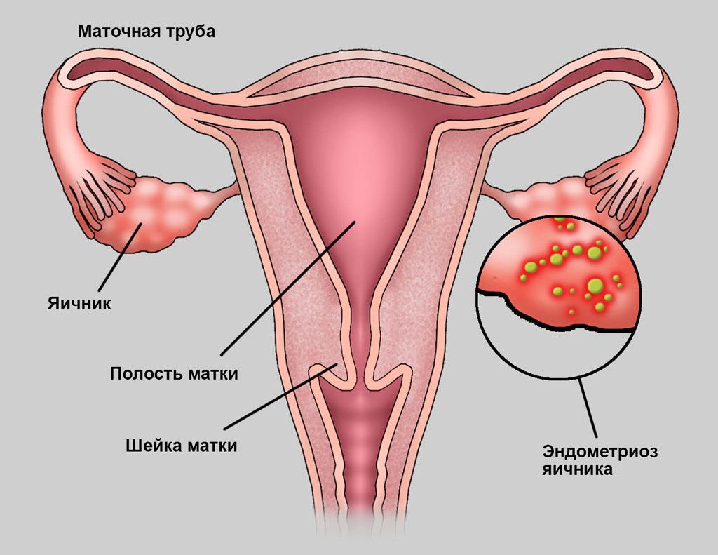 Яичник и матка