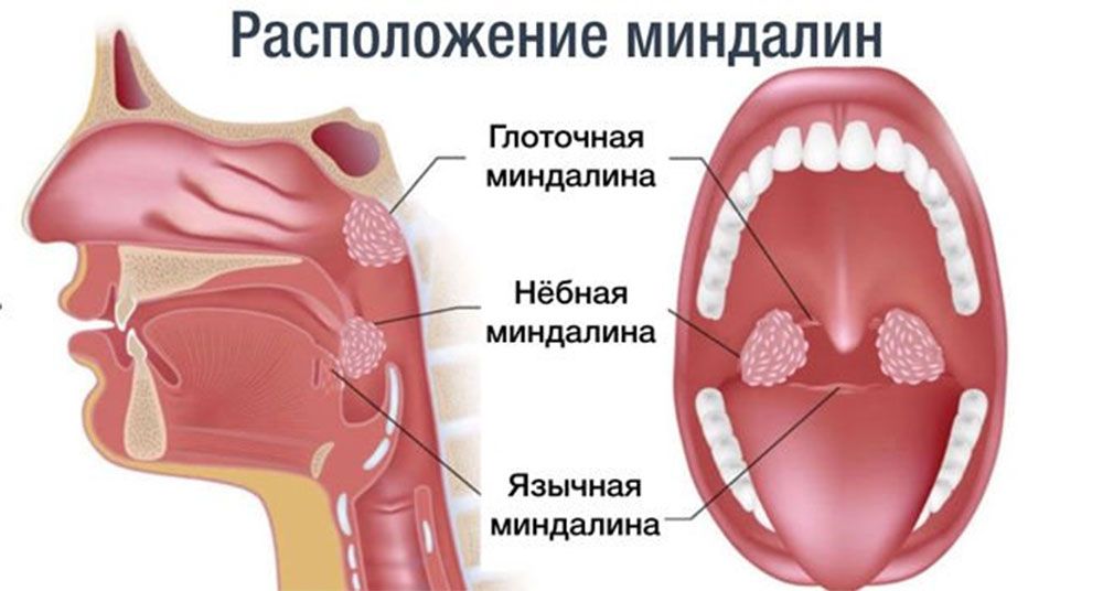 Расположение миндалин