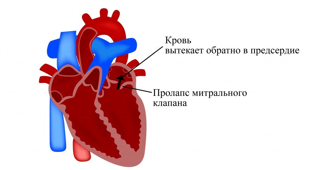 митралный клапан.jpg