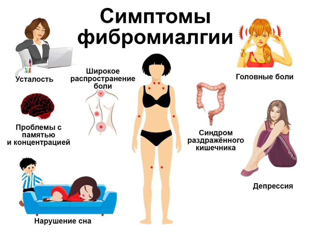 Симптомы фибромиалгии