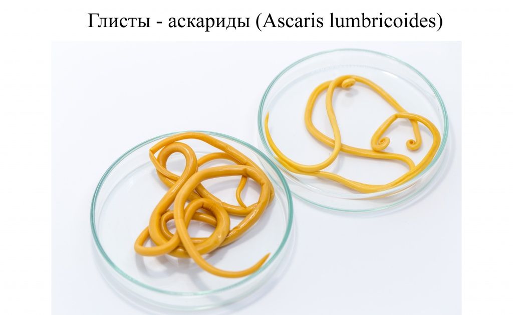 Глисты аскариды