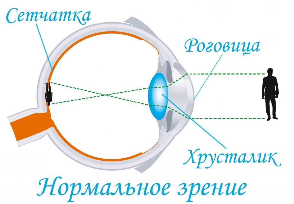 Нормальное зрение.jpg
