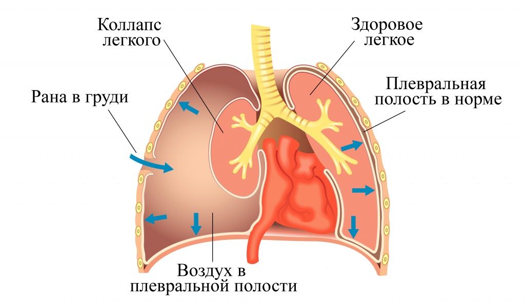 коллапс.jpg